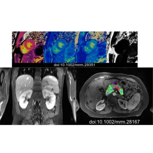 Composite image showing various MRI scans used for quantitative tissue analysis.