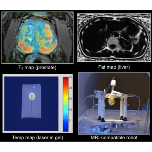 Composite image showing advanced MRI applications and technology.
